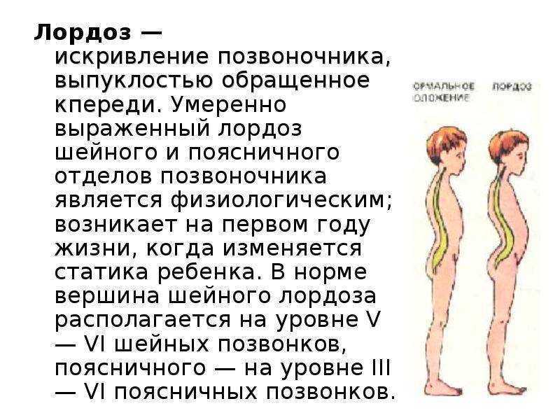 Нейтральное положение позвоночника | fpa
