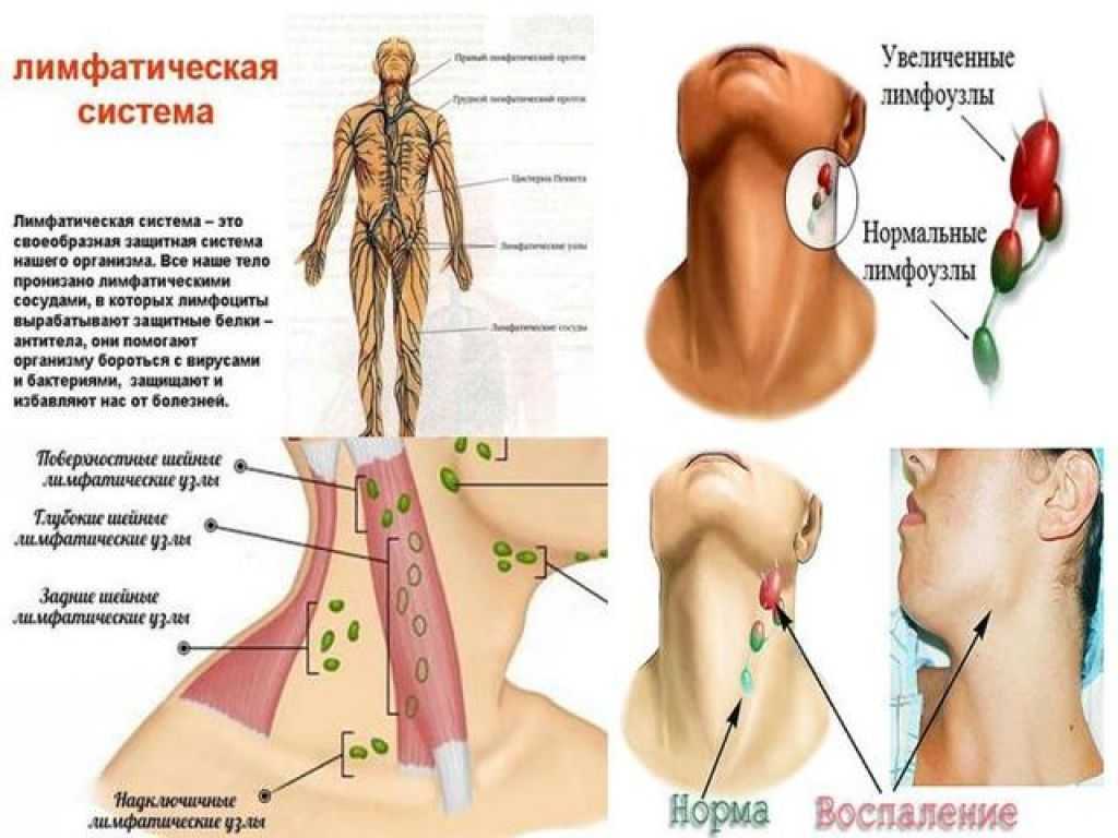 Подчелюстные лимфоузлы норма размера у взрослого