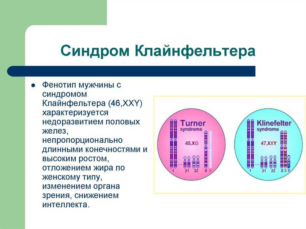 Презентация на тему синдром клайнфельтера генетика