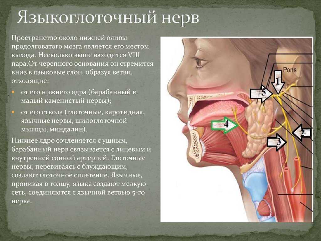 Патологическая извитость сонных артерий