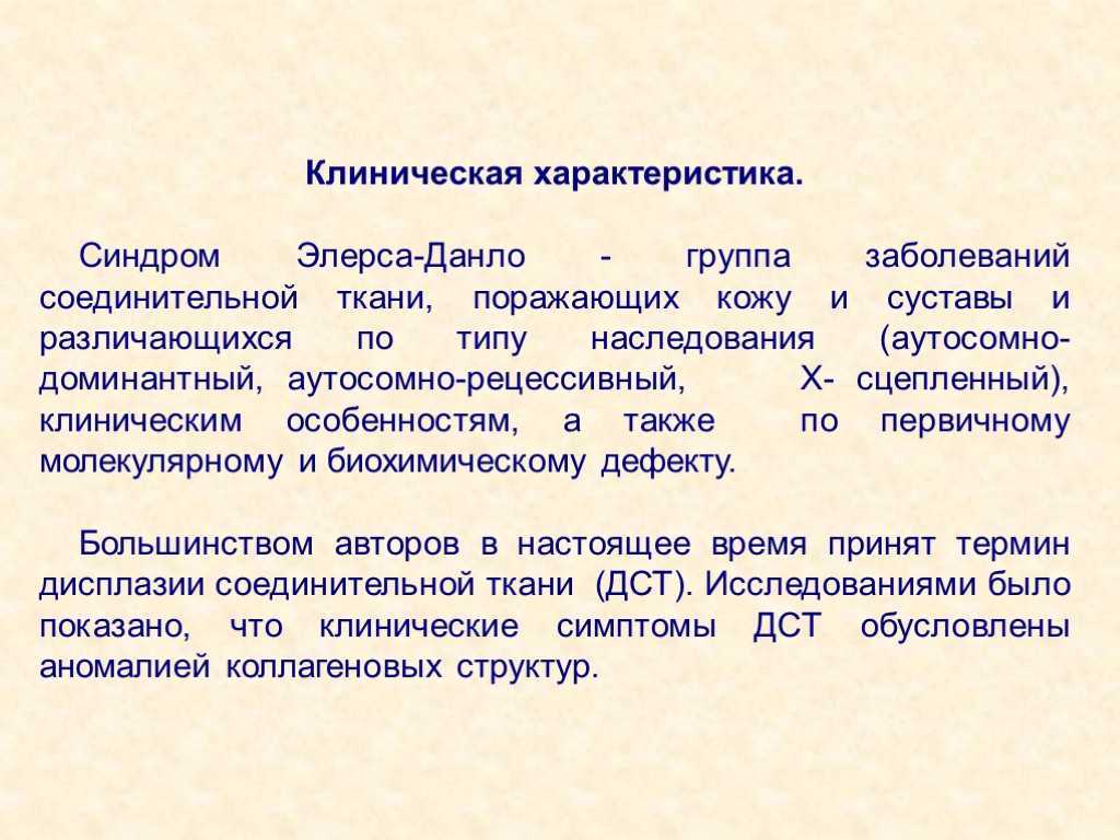 Синдром марфана