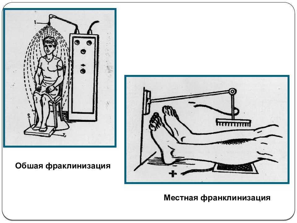 Схема поток электрофорез