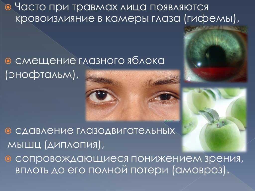 Травмы околоносовых пазух