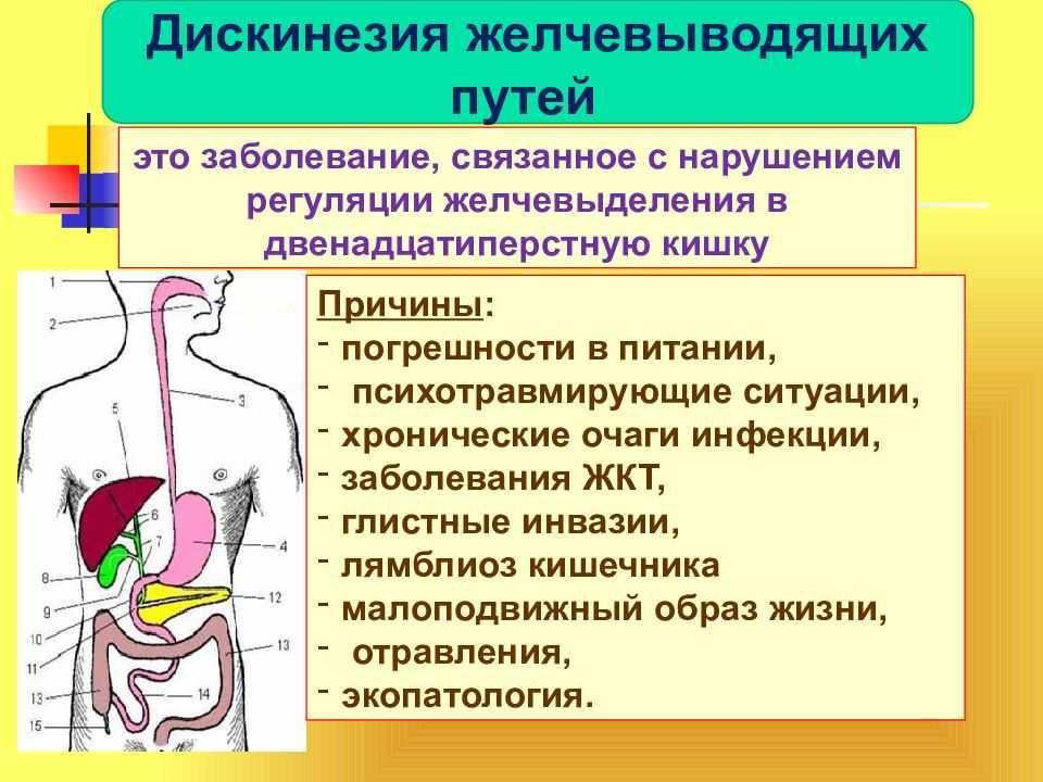 Дискинезия желчевыводящих путей презентация