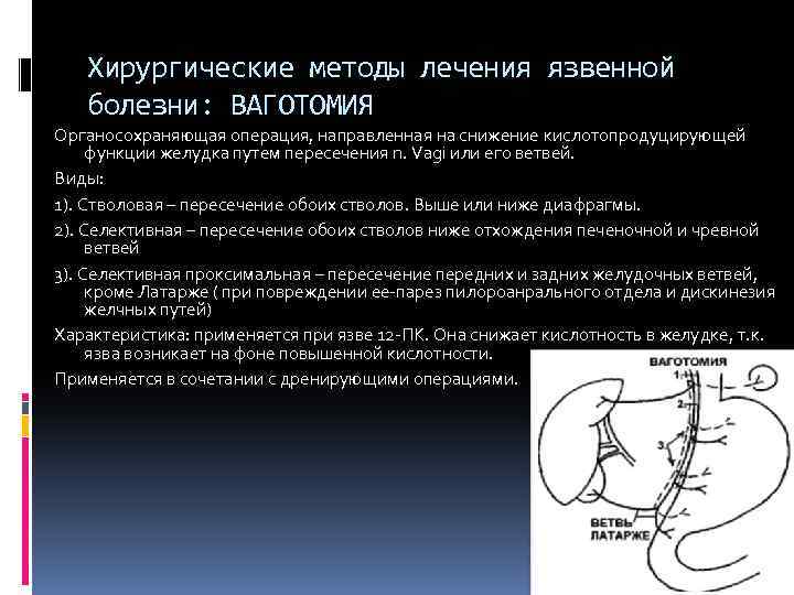 План сестринских вмешательств при язвенной болезни 12 перстной кишки