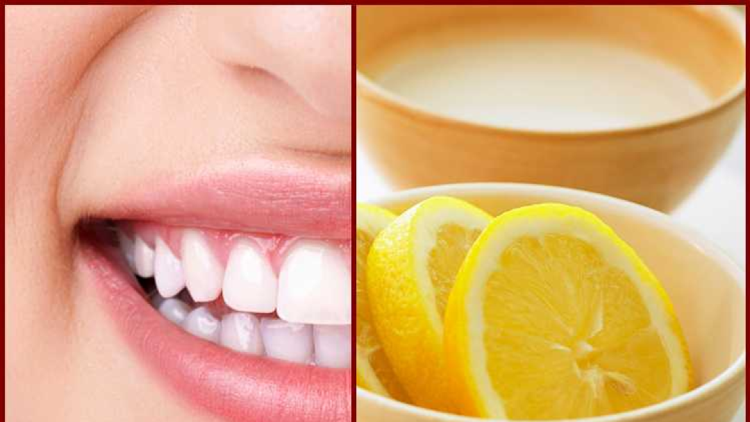 Как стать обладателем белых зубов: советы для белоснежной улыбки, эффективные и безопасные способы отбеливания