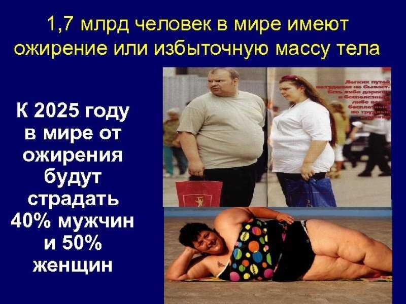 Ожирение 2 степени у женщин фото людей