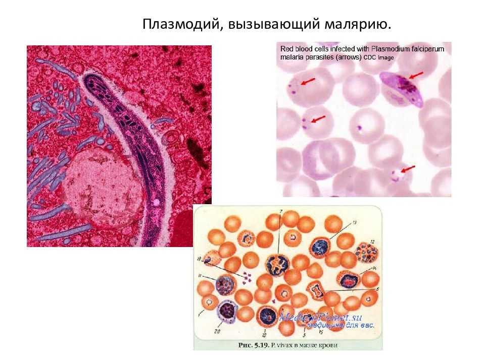 Малярийный плазмодий клетка. Малярийный плазмодий. Малярийный плазмодий возбудитель. Споровики малярийный плазмодий. Эритроциты с малярийными плазмодиями внутри.