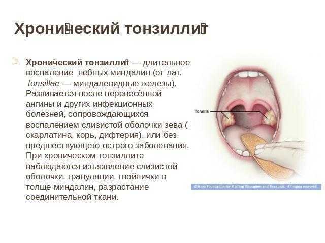 Самые важные симптомы диабета. как распознать первые симптомы заболевания? * клиника диана в санкт-петербурге