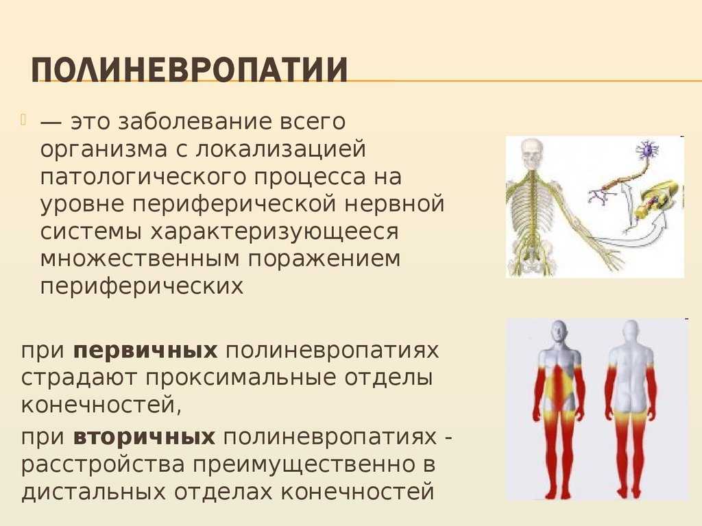 Диабетическая, алкогольная, токсическая нейропатия, сенсорная нейропатия малых волокон (sfsn)
