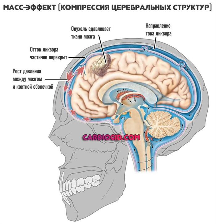 Церебральные структуры мозга. Ликвор в головном мозге. Циркуляция ликвора. Движение ликвора в головном мозге. Патологическое пространство