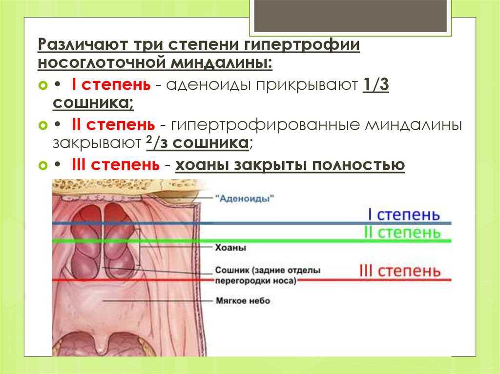 Аденоиды у ребенка - откуда берутся, признаки и симптомы