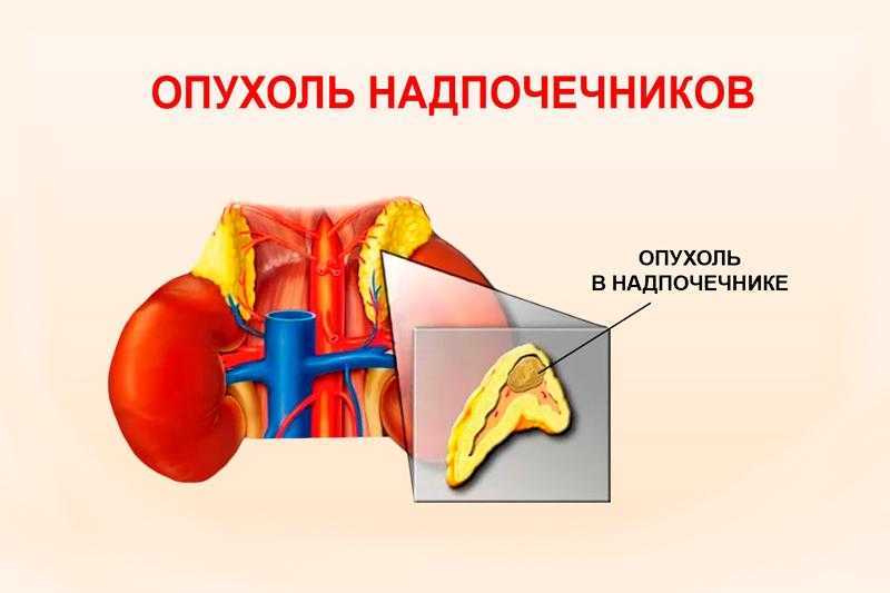 Лучевая терапия