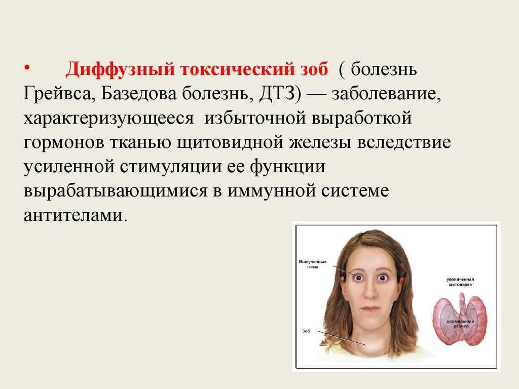 Зачем проверяют гормоны щитовидки?
