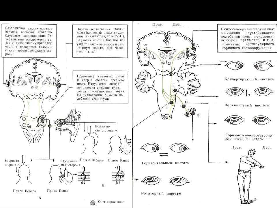 Преддверно-улитковый нерв (viii) человека | анатомия преддверно-улиткового нерва, строение, функции, картинки на eurolab