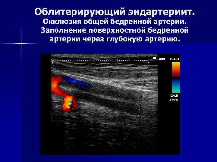 Анатомия голени