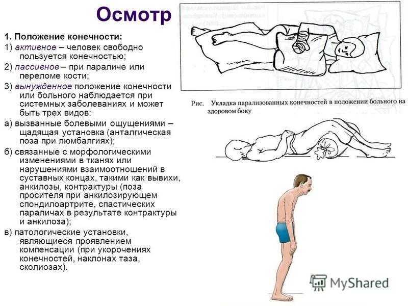 Онемение в ноге