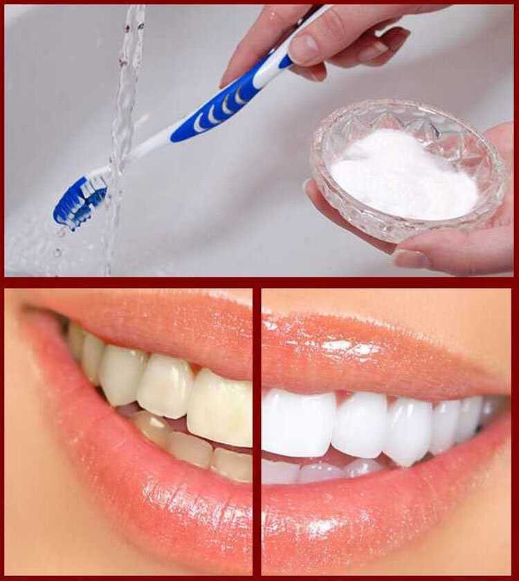 Отбеливание зубов: какие есть способы? – lifekorea.ru