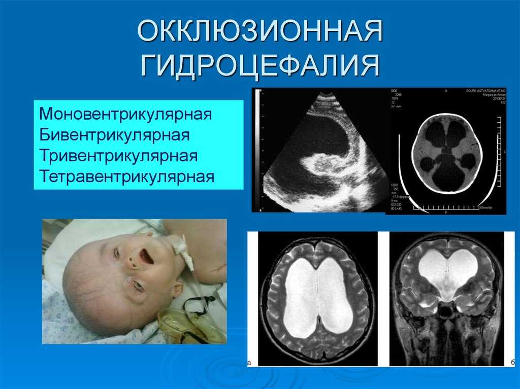 Гормоны гипофиза: виды, признаки нарушений, заболевания