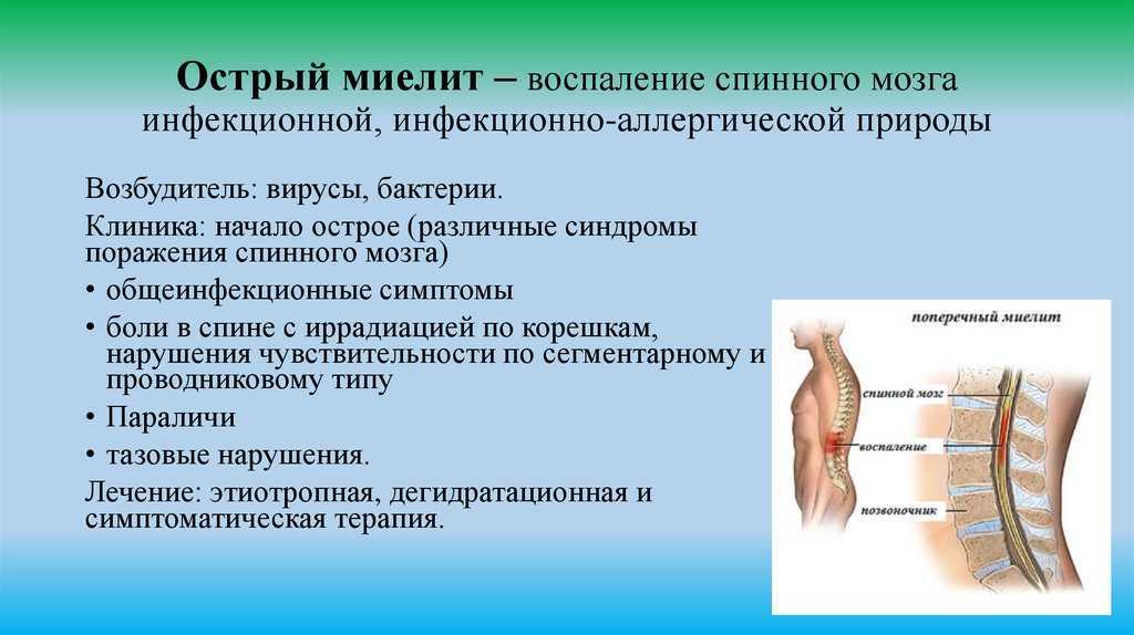 Синдром конского хвоста - лечение, симптомы, причины, диагностика | центр дикуля