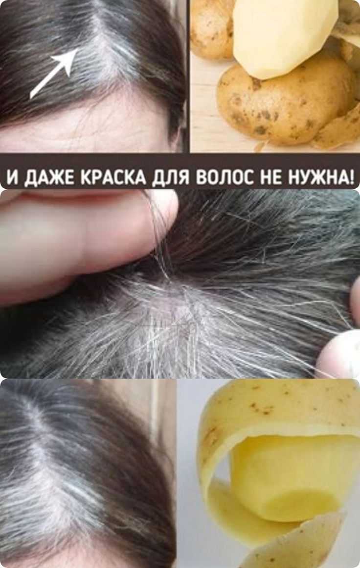 Гирсутизм у женщин: причины и лечение | статьи | бионика