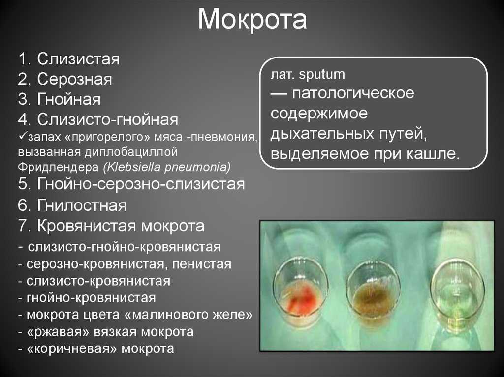 Острый трахеит: симптомы и лечение хронического трахеита, методы диагностики