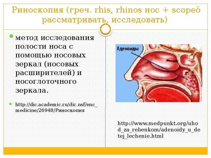 Схема лечения аденоидов у детей 2 степени