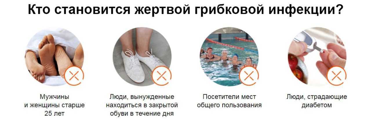 Грибок стопы: причины, симптомы, лечение микоза