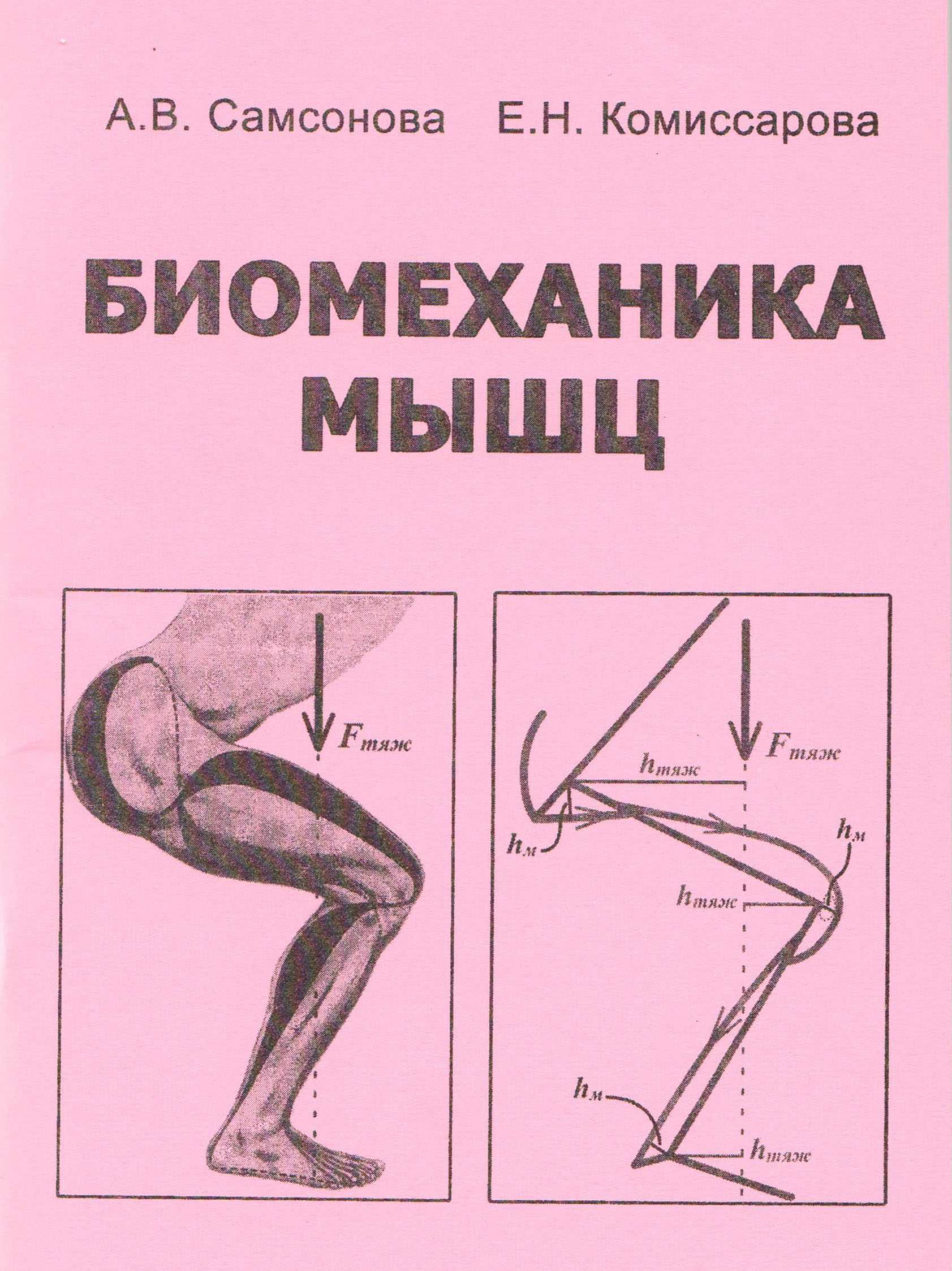 Атрофия четырехглавой мышцы бедра