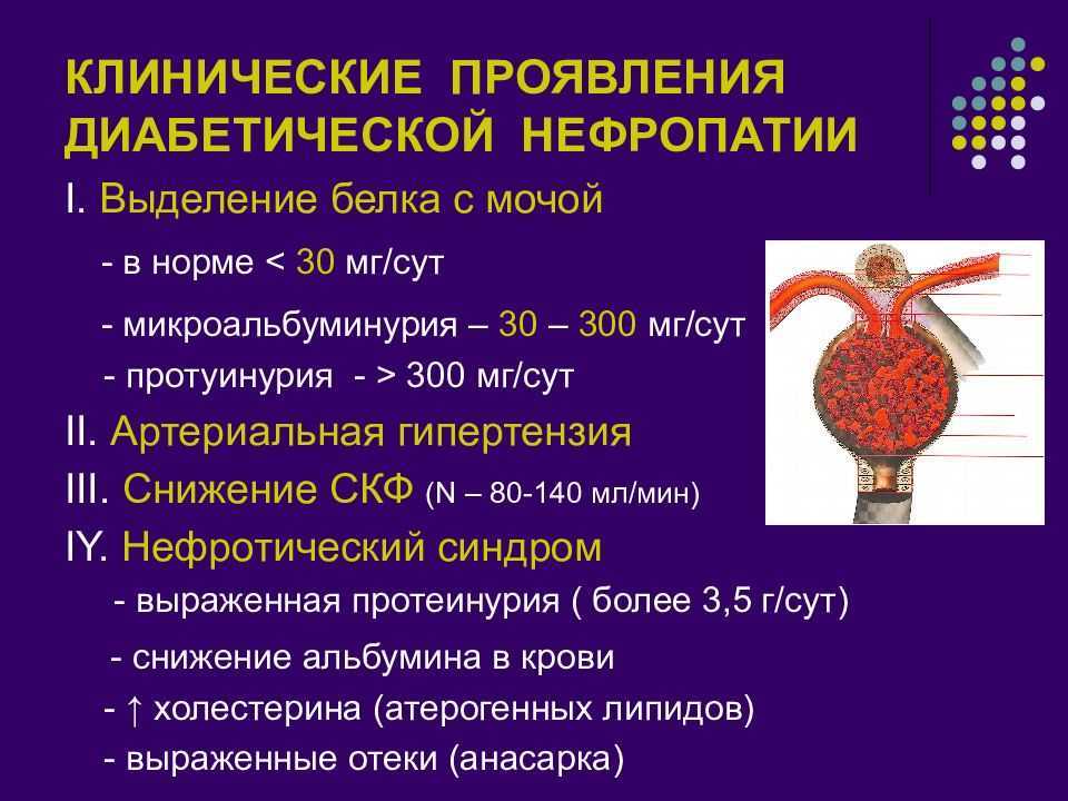 Диабетическая нефропатия презентация