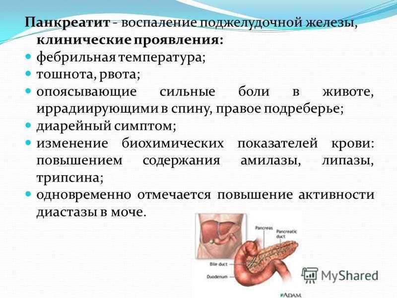 Острый панкреатит презентация