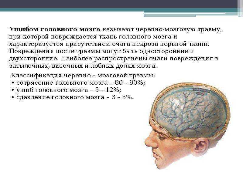 Субдуральное кровоизлияние