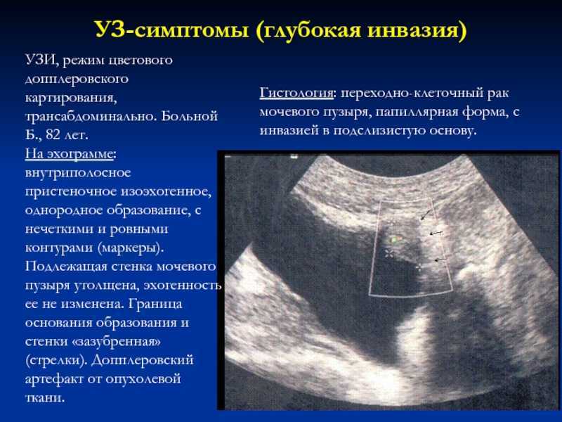 Анатомия тазового дна