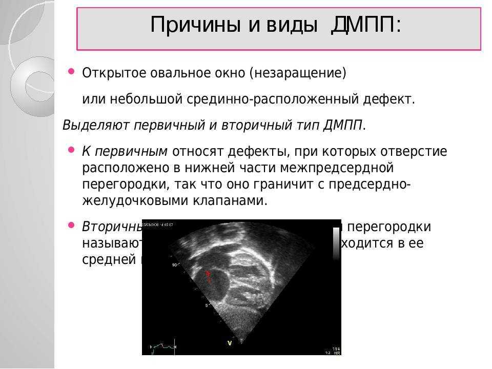 Внутриутробно был диагностирован порок сердца у ребенка: причины, исследования