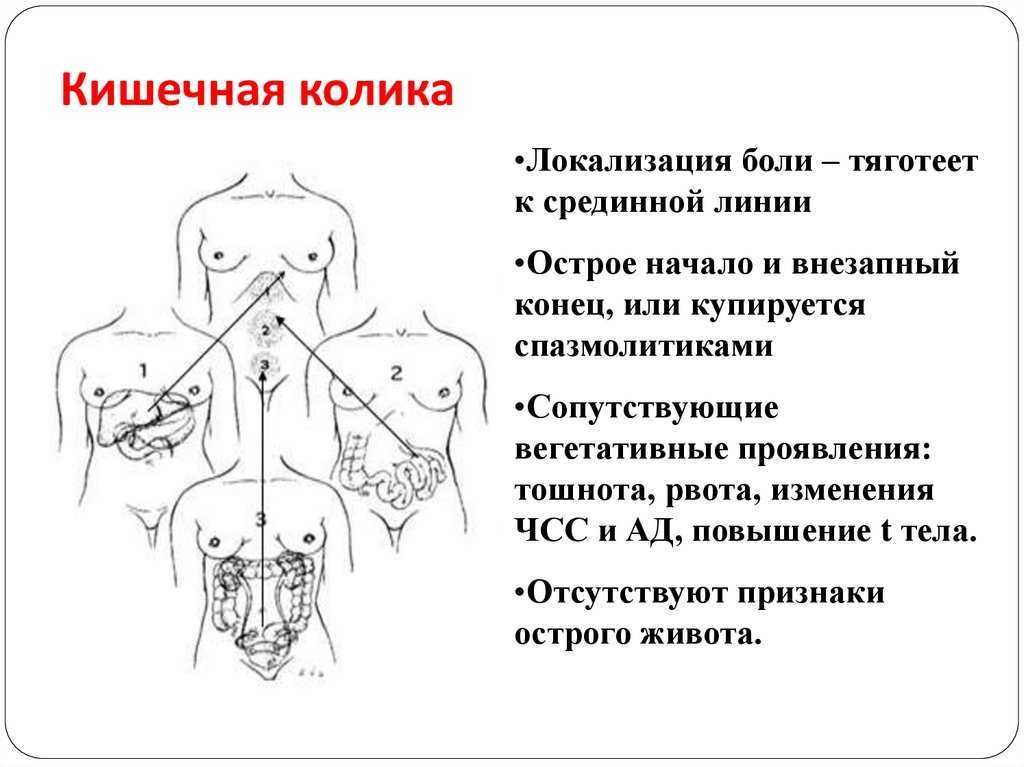 Спазм кишечника