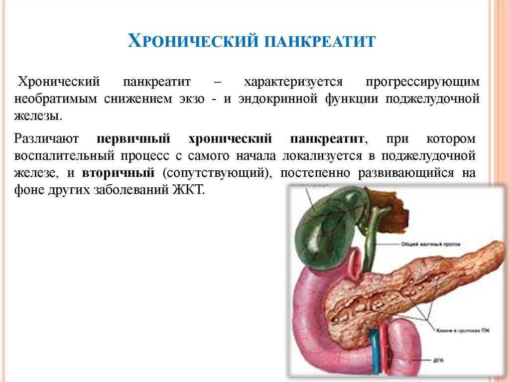 Острый панкреатит б. Панкреатин поджелудочная железа. Хронический панкреатит поджелудочная железа. Хронический панкреатит характеризуется. Болезни поджелудочной железы хронический.