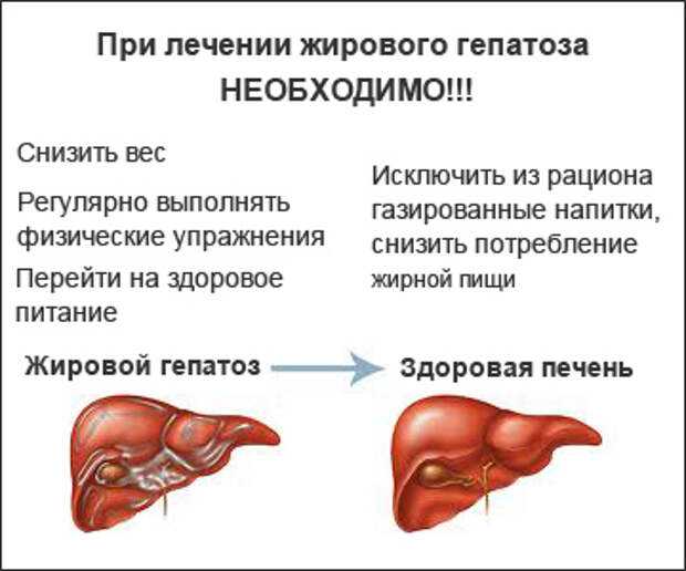 Сосудистый рисунок печени обеднен что это значит при гепатозе