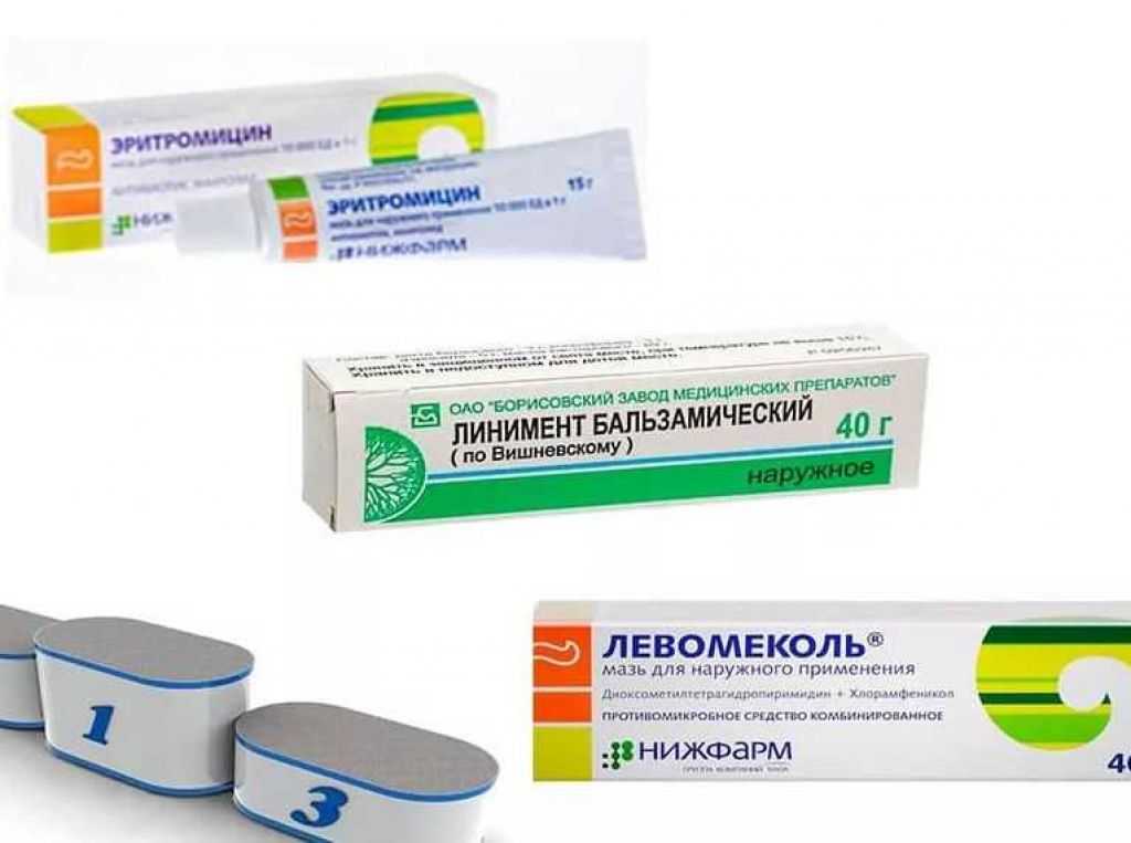 Бурсит: описание болезни, причины, симптомы, методы лечения | артракам