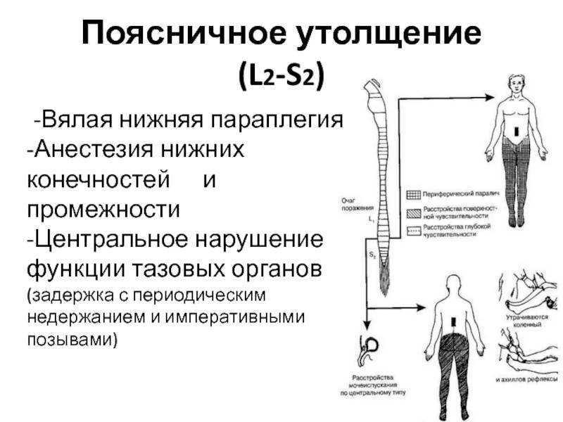 Нарушение функции органов, двигательные расстройства при болезнях нервной системы - медицинский центр «эхинацея»