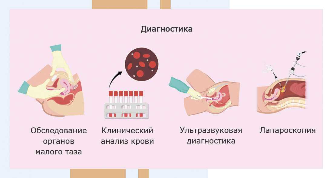 Лечение предменструального дисфорического расстройства • центр гинекологии в санкт-петербурге