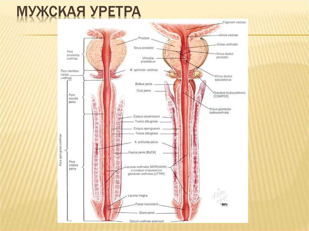 Уретрит