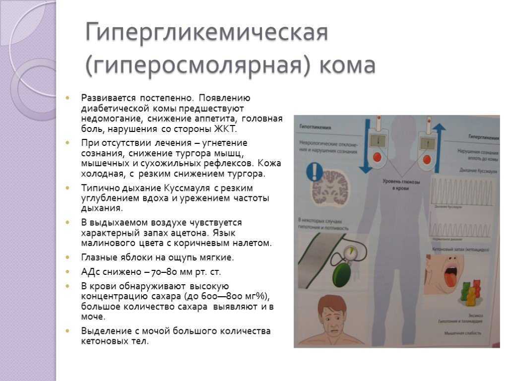 Карта вызова смп гипергликемия сахарный диабет