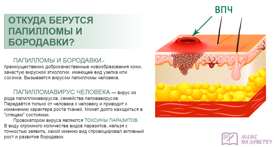 Вирус папилломы человека. симптомы и лечение впч.!