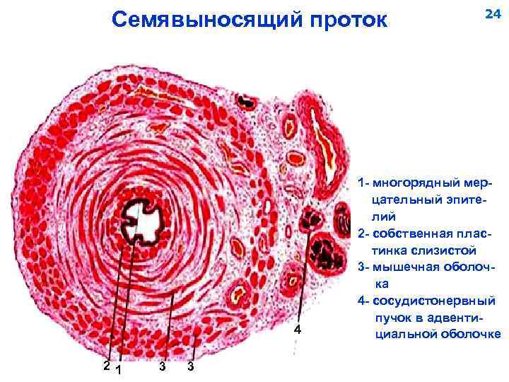 Обструкция семявыводящих путей