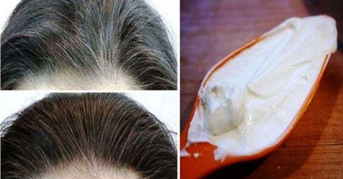Как избавиться от серы на волосах