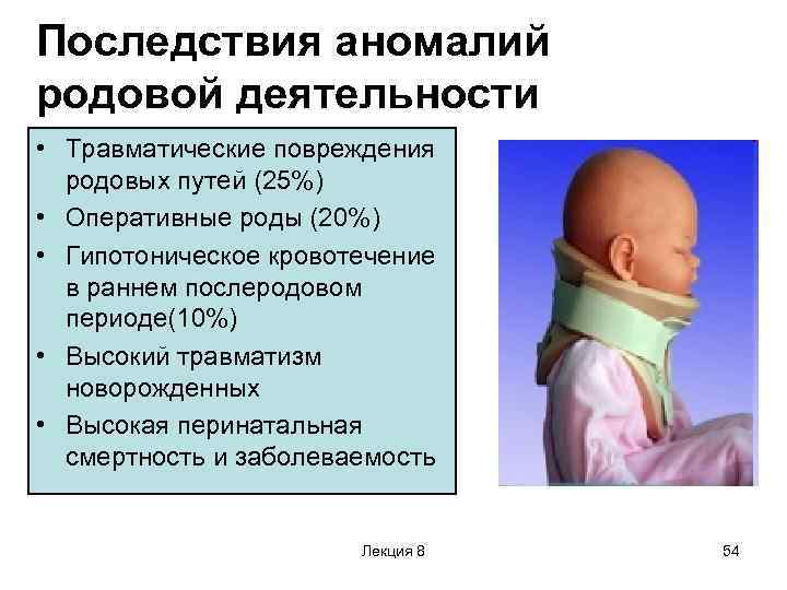 Слабая родовая деятельность
