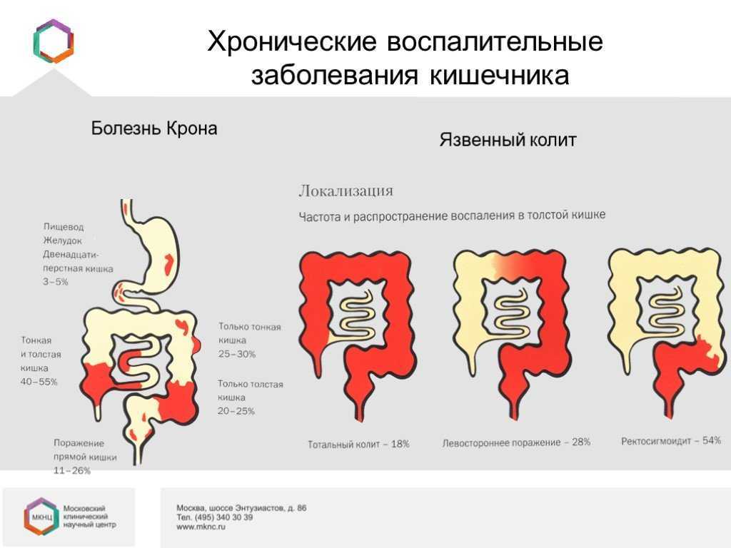 Клиническая картина няк
