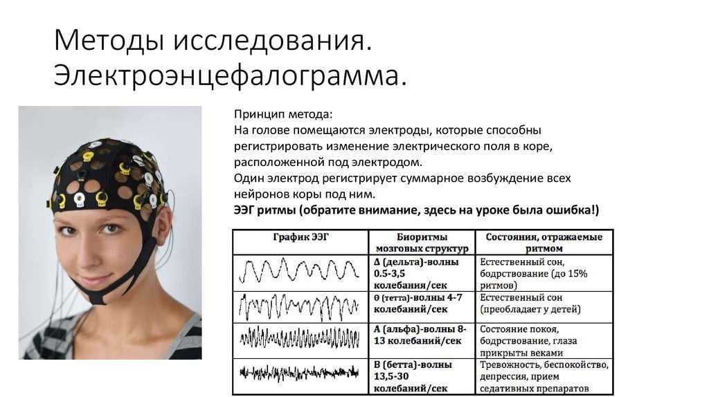 Электроэнцефалография (ээг)