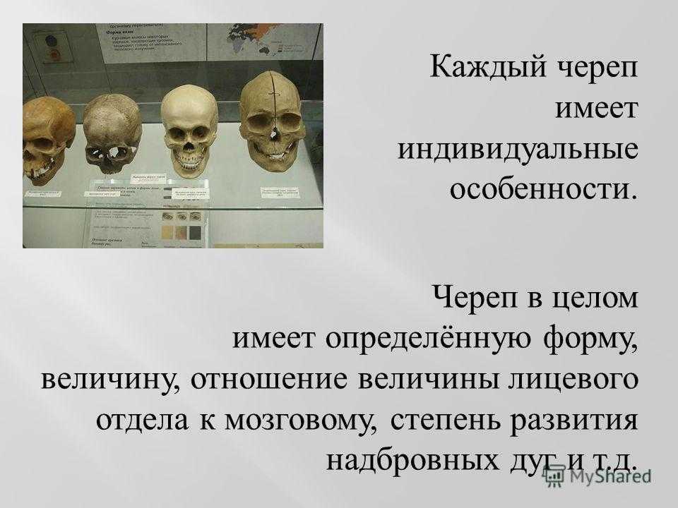 Череп иметь. Индивидуальные особенности черепа. Особенности черепа человека. Краниометрические данные черепа. Параметры форма черепа.