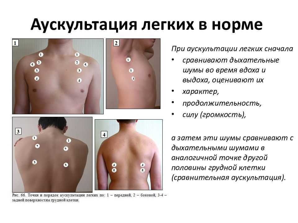 Аускультация сердца (точки выслушивания) в норме, пальпация и перкуссия